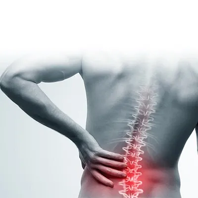 Layanan Patah Tulang Belakang