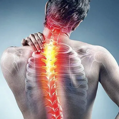 Layanan Saraf Kejepit